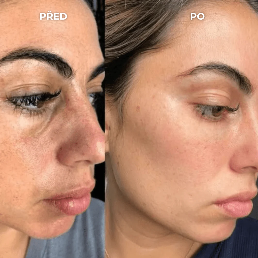 SEOYA – Korejský rýžový peeling 30 ml