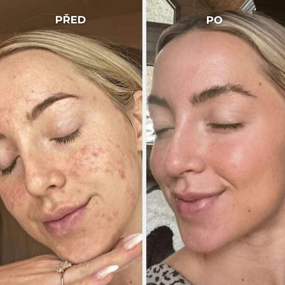 SEOYA – Korejský rýžový peeling 30 ml