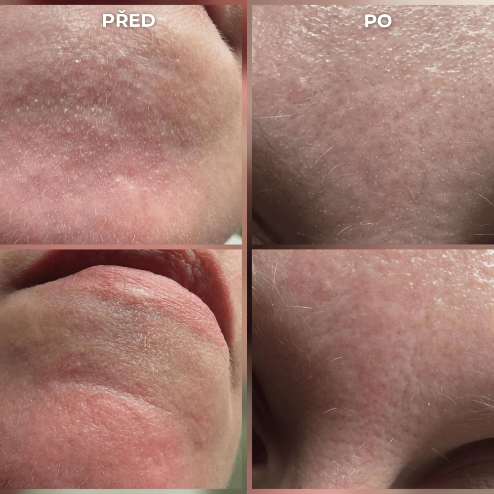 SEOYA – Korejský rýžový peeling 30 ml